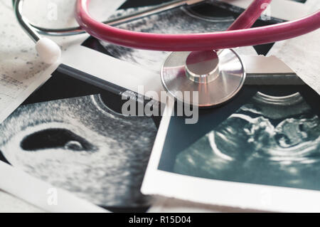 Nelle immagini di ultrasuoni 4 settimane di gravidanza e 20 settimane è un phonendoscope. Il concetto di studio della gravidanza. Osservazione f selettiva Foto Stock