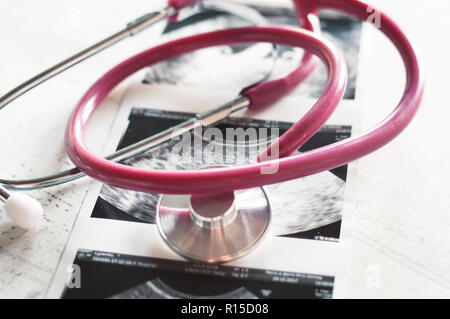 Nelle immagini di ultrasuoni 4 settimane di gravidanza e 20 settimane è un phonendoscope. Il concetto di studio della gravidanza. Osservazione f selettiva Foto Stock