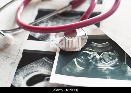 Nelle immagini di ultrasuoni 4 settimane di gravidanza e 20 settimane è un phonendoscope. Il concetto di studio della gravidanza. Osservazione f selettiva Foto Stock