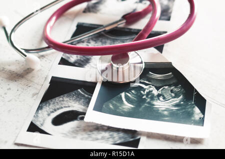 Nelle immagini di ultrasuoni 4 settimane di gravidanza e 20 settimane è un phonendoscope. Il concetto di studio della gravidanza. Osservazione f selettiva Foto Stock