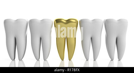 La salute dei denti, dentristy concetto. Dente Bianco modelli e uno d'oro isolati su sfondo bianco. 3d illustrazione Foto Stock
