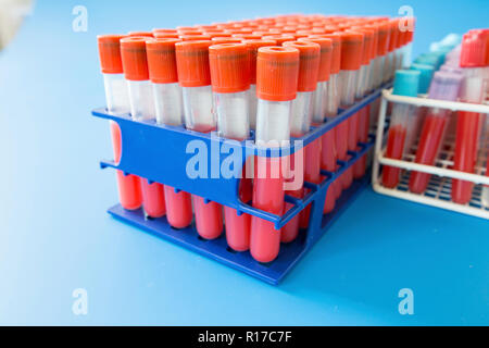 Rack di provette. Foto Stock