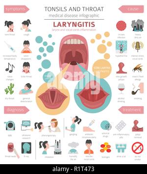 Le tonsille e malattie della gola. Laringiti sintomi, trattamento icon set. Infografico medica design. Illustrazione Vettoriale Illustrazione Vettoriale