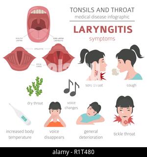 Le tonsille e malattie della gola. Laringiti sintomi, trattamento icon set. Infografico medica design. Illustrazione Vettoriale Illustrazione Vettoriale