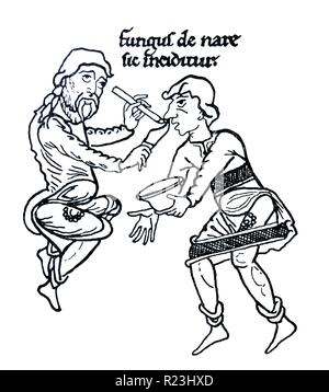 Disegno del trattamento medievale di una nasale afflizione. Il testo di cui sopra è "Fungo de nase sic inciditur' che si traduce in "Così polipo è tagliato fuori il naso". Datato xii secolo Foto Stock
