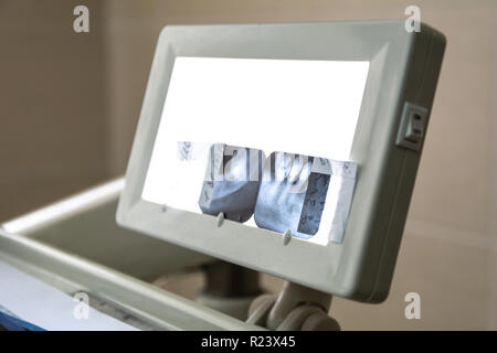 X-ray immagine sullo sfondo a led. Per le cure dentarie, igiene dentale, checkup e concetto di terapia. Foto Stock