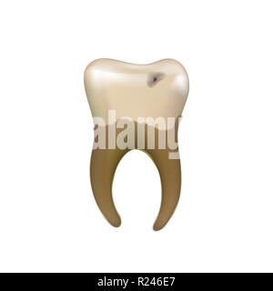 Vecchi malati dente umano con la carie isolato su bianco Illustrazione Vettoriale