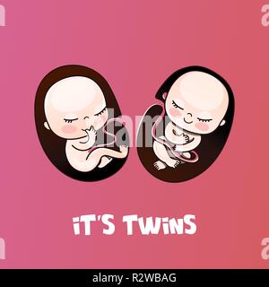 Barra di avanzamento con iscrizione - Twins il caricamento e il neonato ragazze volti in stile sketchy. Illustrazione Vettoriale per t-shirt design, poster, scheda, baby shower decoration Illustrazione Vettoriale