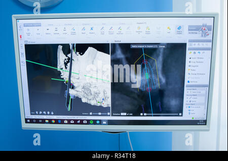 Screenshoot di odontoiatria strumento per implantologia Foto Stock