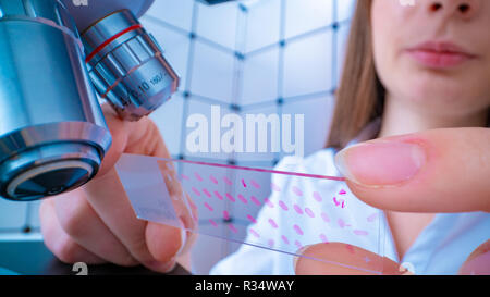 Scienziato analizzando vetrino del microscopio in laboratorio. Giovane donna tecnico sta esaminando un campione istologico, una biopsia in laboratorio di cancro ri Foto Stock