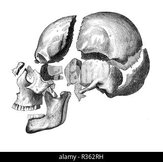 Vintage illustrazione di anatomia, cranio con ganascia e denti, osso vista di decomposizione Foto Stock