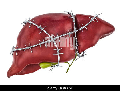 Il dolore di fegato di concetto. Il fegato umano con filo spinato. 3D rendering isolati su sfondo bianco Foto Stock