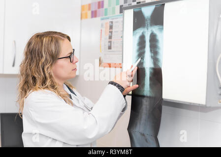 Medico donna esaminando la radiografia in ospedale Foto Stock