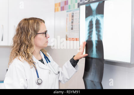 Medico donna esaminando la radiografia in ospedale Foto Stock