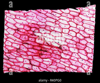 Onion micrografia epidermus Foto Stock