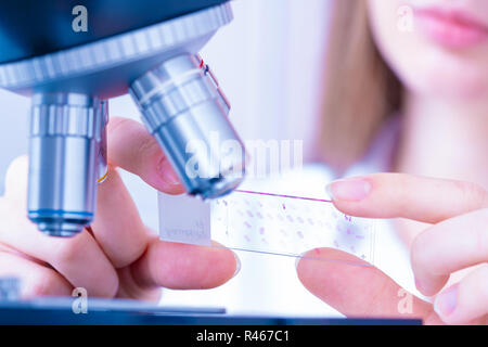 Scienziato analizzando vetrino del microscopio in laboratorio. Giovane donna tecnico sta esaminando un campione istologico, una biopsia in laboratorio di cancro ri Foto Stock