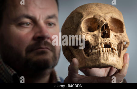 È sotto embargo per 0001 Martedì 27 Novembre Dr Hugh Willmott, Senior Lecturer in unione Archeologia Storica dell'Università di Sheffield, detiene un teschio umano che è stato scoperto durante gli scavi presso un precedentemente sconosciuto cimitero anglosassone che dissotterrato sontuoso sepolture di donne con i loro gioielli e oggetti personali. Foto Stock