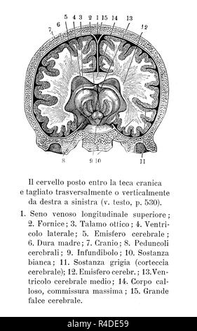 Vintage illustrazione di anatomia, il cervello umano in sezione trasversale nel cranio, descrizioni anatomiche in italiano Foto Stock