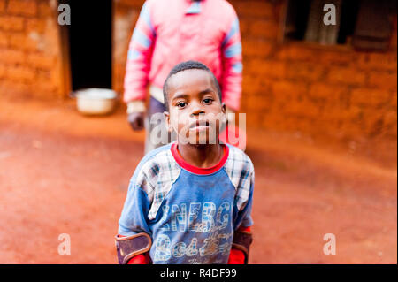 Bafoussam, Camerun - 6 agosto 2018: giovane ragazzo africano cercando nella fotocamera con espressione seria nel villaggio rurale di camminare con le stampelle Foto Stock