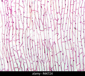 Onion micrografia epidermus Foto Stock