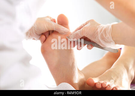 Piedi sani. callo sul piede. impronta sul piede. il medico rimuove l impronta del piede con un bisturi Foto Stock