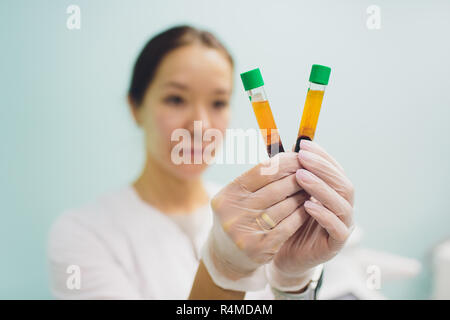 Preparazione per Plasmolifting. Provette per prelievo ematico in due strati divisi per centrifugazione dopo la manipolazione di personalizzazione. Foto Stock