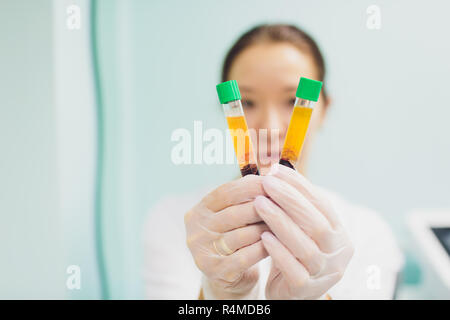 Preparazione per Plasmolifting. Provette per prelievo ematico in due strati divisi per centrifugazione dopo la manipolazione di personalizzazione. Foto Stock