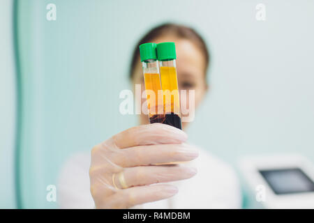 Preparazione per Plasmolifting. Provette per prelievo ematico in due strati divisi per centrifugazione dopo la manipolazione di personalizzazione. Foto Stock