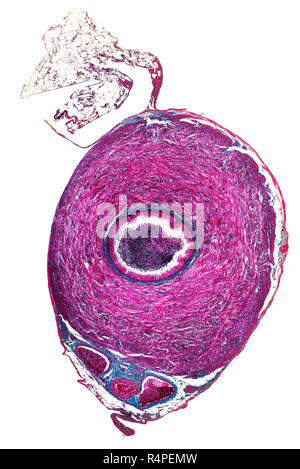 Dotto deferens micrografia Foto Stock