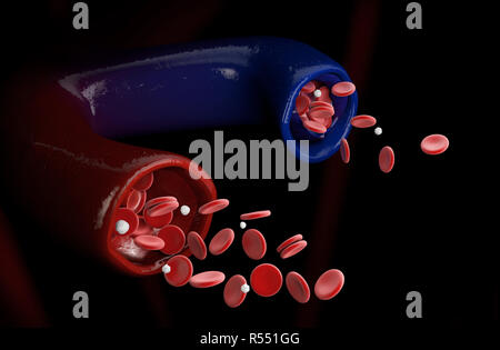 3d illustrazione della vena varicosa e vena normale, vene varicose Foto Stock