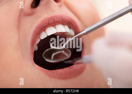 Close-up di una donna che passa attraverso il trattamento dentale in clinica Foto Stock