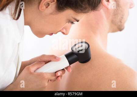 Medico utilizzando Dermatoscope per esame della pelle Foto Stock