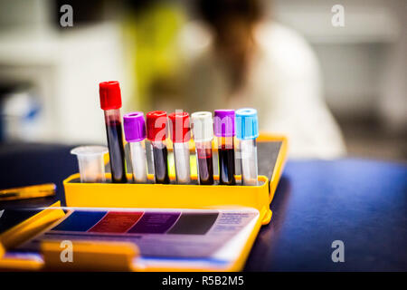 Infermiera liberale tenendo il campione di sangue da un paziente. Foto Stock
