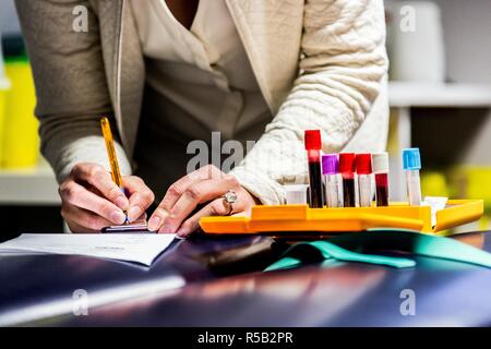 Infermiera liberale tenendo il campione di sangue da un paziente. Foto Stock