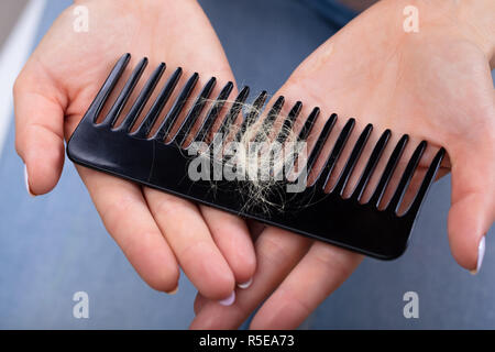 Close-up di una donna di mano azienda pettine con perdita di capelli Foto Stock