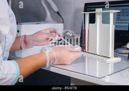 Ambulatorio medico. Infermiere al suo posto di lavoro. Riempire la pipetta con il sangue dal tubo Foto Stock