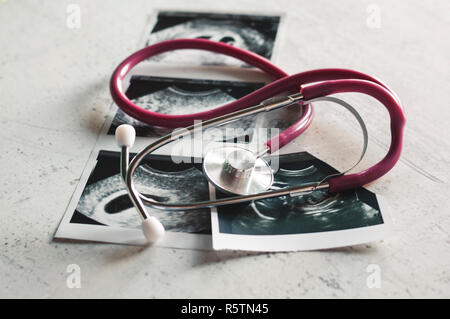 Nelle immagini di ultrasuoni 4 settimane di gravidanza e 20 settimane è un phonendoscope. Il concetto di studio della gravidanza. Osservazione f selettiva Foto Stock