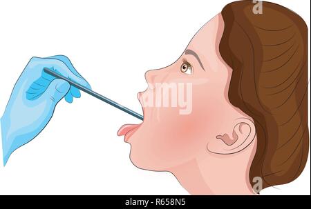 Illustrazione del mal di gola. Ispezione della gola. angina Illustrazione Vettoriale