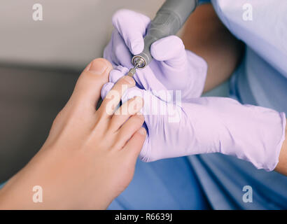 Pedicure il trattamento di un piede di un paziente, il trattamento di pedicure Foto Stock