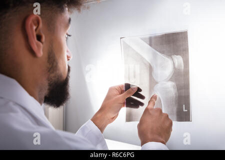 Medico esaminando ginocchio X-ray Foto Stock