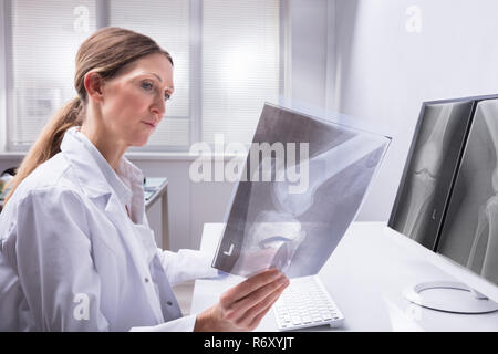 Medico esaminando ginocchio X-ray Foto Stock