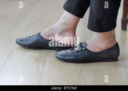 Donna anziana mettendo in scarpe. Foto Stock