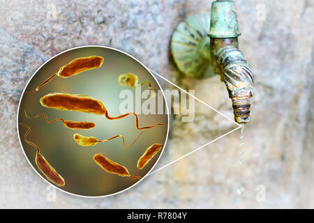 Sicurezza dell'acqua potabile. Illustrazione concettuale e fotografia che mostra il batterio Vibrio cholerae in una goccia di acqua da una vecchia strada tocca. Foto Stock