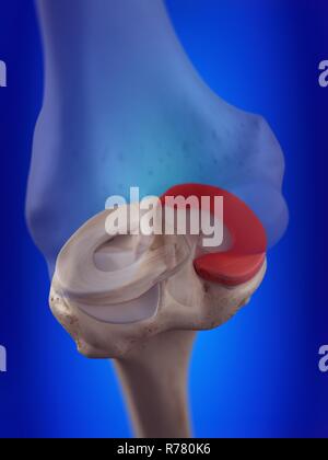 3d reso illustrazione del menisco mediale. Foto Stock