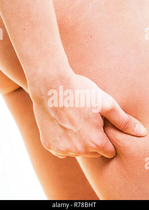 Donna cellulite controllo sulle sue gambe Foto Stock