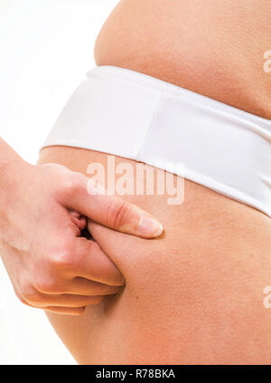 Close up donna cellulite controllo sulle sue natiche Foto Stock