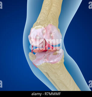 L'osteoporosi della giuntura di ginocchio, accurata dal punto di vista medico 3D illustrazione Foto Stock