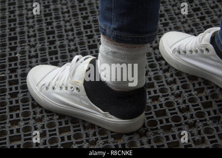 Bendato gamba femminile. Ferite. dolore medicina. Foto Stock