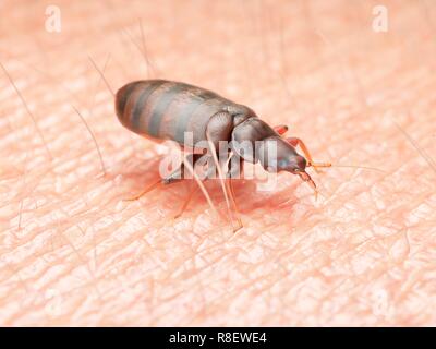 Illustrazione di un bedbug sulla pelle umana. Foto Stock