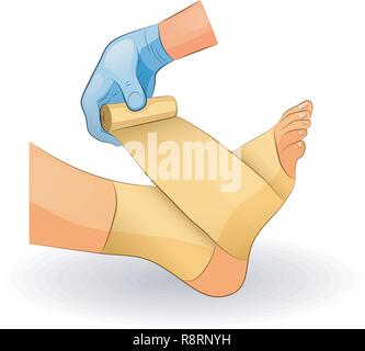 Illustrazione vettoriale di un bendaggio in caso di lesioni dell'articolazione della caviglia Illustrazione Vettoriale